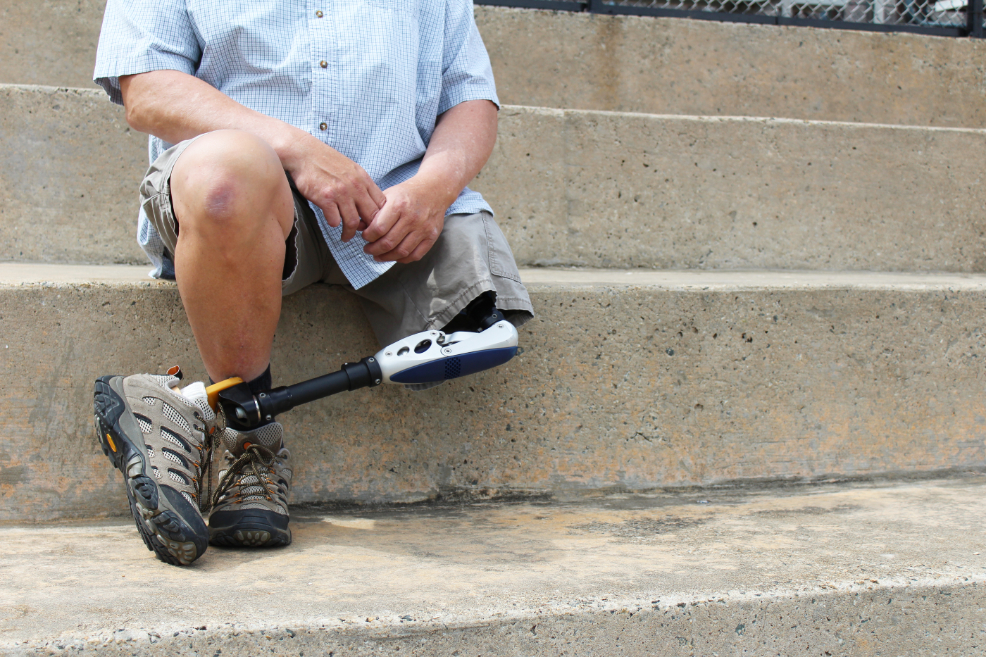 Man sitting on concrete stairs with a robotic leg after a life altering injury